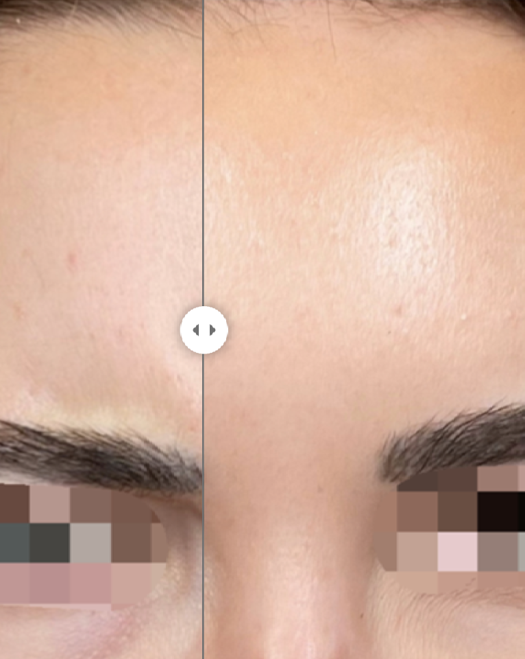 Before and After Treatment