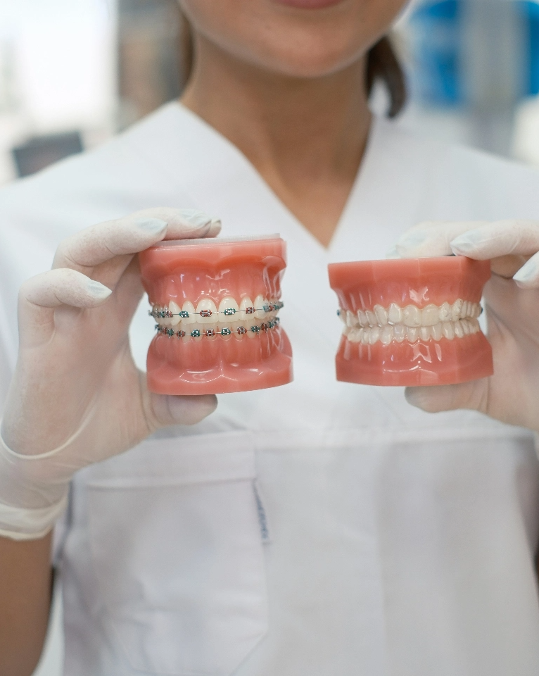 A person in a white coat and gloves holds two dental models: one with braces and one with straight teeth.
