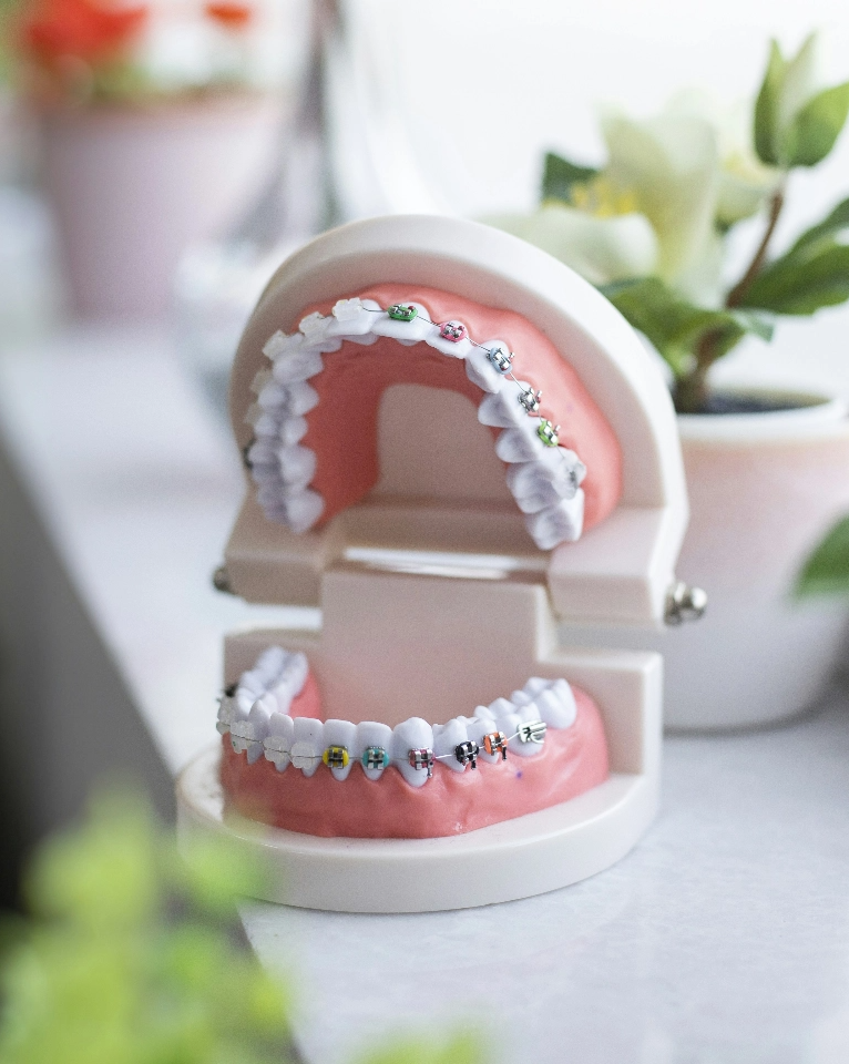 A dental model showcasing braces with flowers and decorative elements on the teeth, displayed on a tabletop next to potted plants.